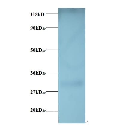 G-protein coupled receptor 161 Polyclonal Antibody from Signalway Antibody (42408) - Antibodies.com