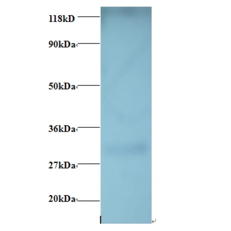 G-protein coupled receptor 161 Polyclonal Antibody from Signalway Antibody (42408) - Antibodies.com