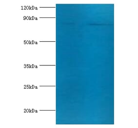 Transferrin receptor protein 1 Polyclonal Antibody from Signalway Antibody (42479) - Antibodies.com