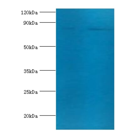 Transferrin receptor protein 1 Polyclonal Antibody from Signalway Antibody (42479) - Antibodies.com