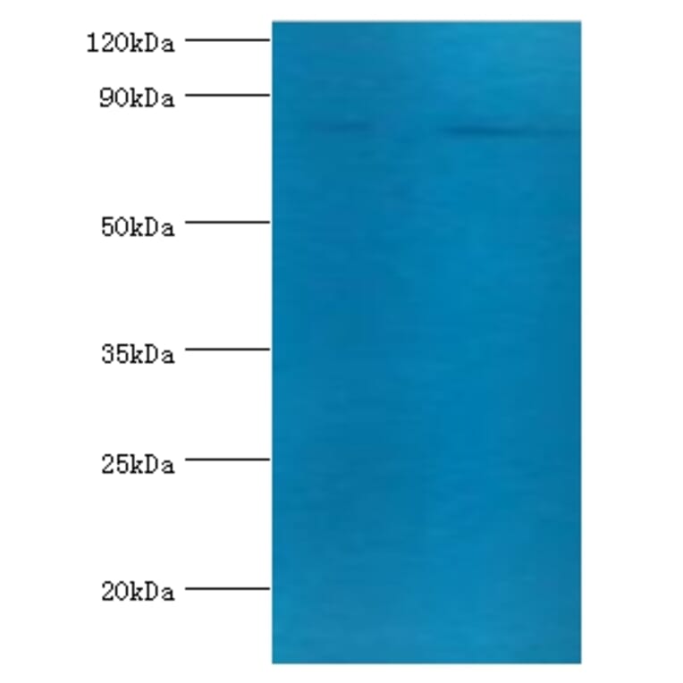 Transferrin receptor protein 1 Polyclonal Antibody from Signalway Antibody (42479) - Antibodies.com