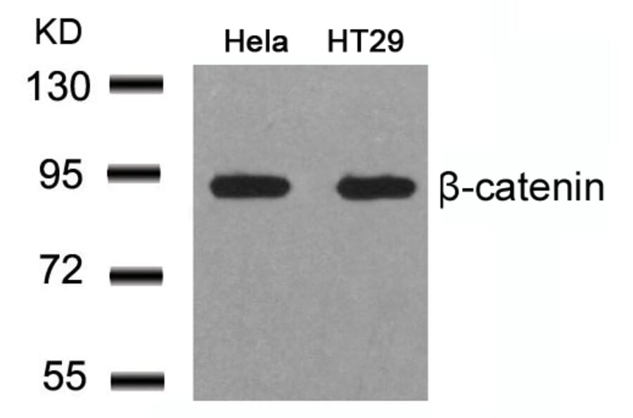 Western blot - b-Catenin (Ab-41/45) Antibody from Signalway Antibody (21103) - Antibodies.com