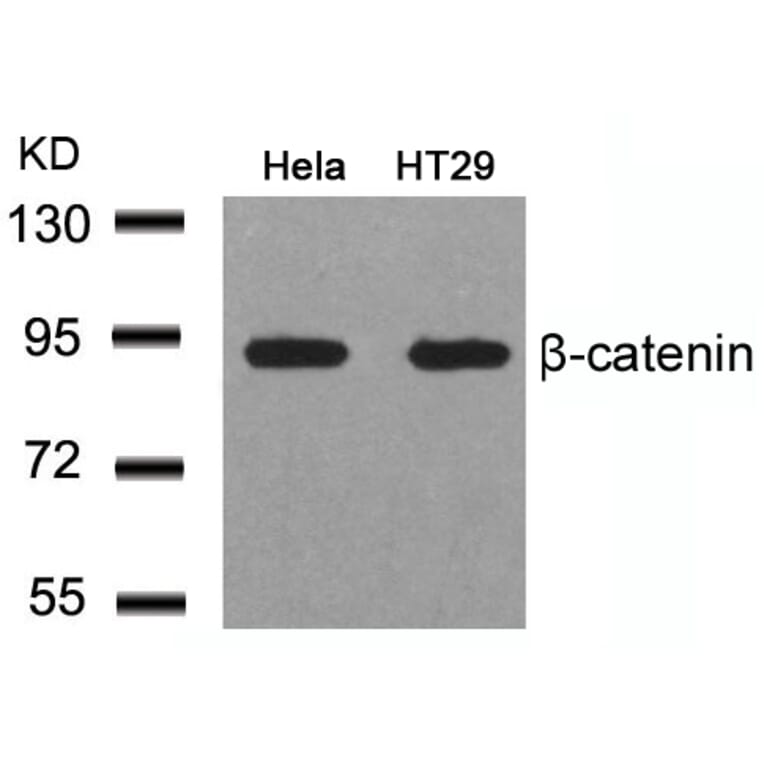 Western blot - b-Catenin (Ab-41/45) Antibody from Signalway Antibody (21103) - Antibodies.com