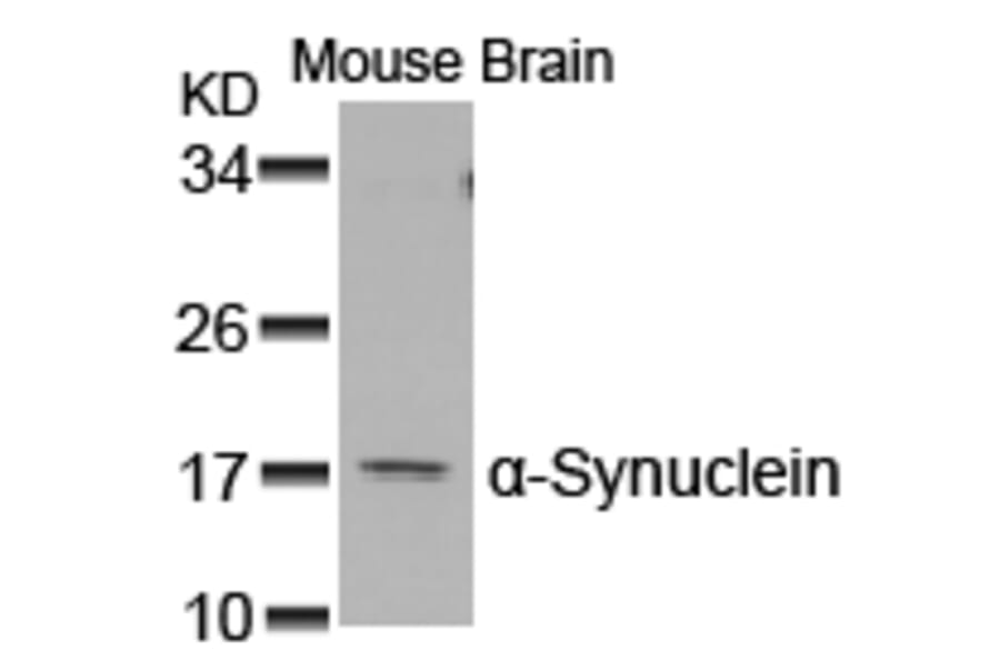 Western blot - a-Synuclein (Ab-129) Antibody from Signalway Antibody (21183) - Antibodies.com