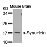Western blot - a-Synuclein (Ab-129) Antibody from Signalway Antibody (21183) - Antibodies.com
