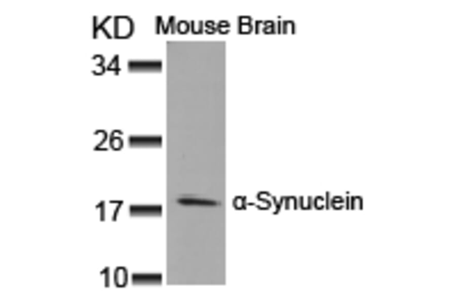 Western blot - a-Synuclein (Ab-125) Antibody from Signalway Antibody (21248) - Antibodies.com