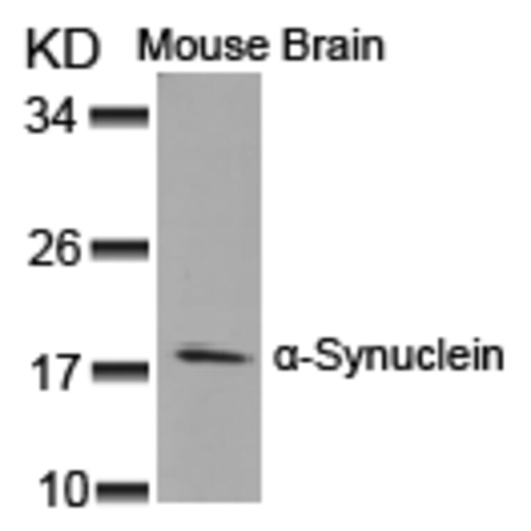 Western blot - a-Synuclein (Ab-125) Antibody from Signalway Antibody (21248) - Antibodies.com