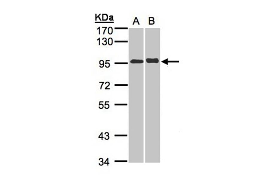 IL-12 Receptor beta2 antibody from Signalway Antibody (22073) - Antibodies.com
