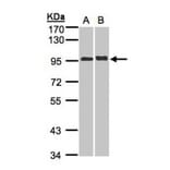 IL-12 Receptor beta2 antibody from Signalway Antibody (22073) - Antibodies.com