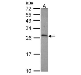 CD27L (CD27L (CD70)) antibody from Signalway Antibody (22409) - Antibodies.com