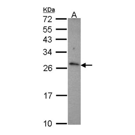 CD27L (CD27L (CD70)) antibody from Signalway Antibody (22409) - Antibodies.com