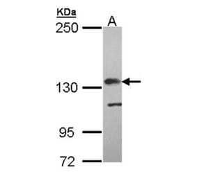 Complement factor H antibody from Signalway Antibody (22665) - Antibodies.com