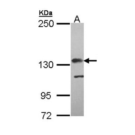 Factor H Antibodies + 