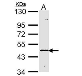 Blood Group Lewis a antibody from Signalway Antibody (22719) - Antibodies.com