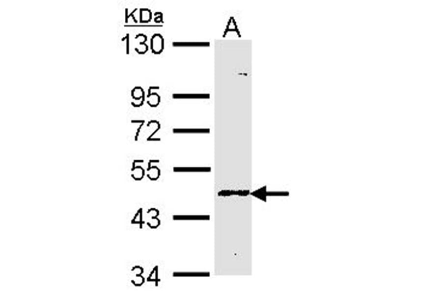 Blood Group Lewis a antibody from Signalway Antibody (22719) - Antibodies.com