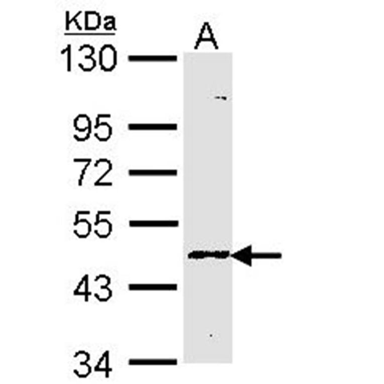 Blood Group Lewis a antibody from Signalway Antibody (22719) - Antibodies.com
