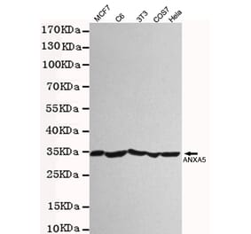 Western blot - Annexin V Polyclonal Antibody from Signalway Antibody (27222) - Antibodies.com