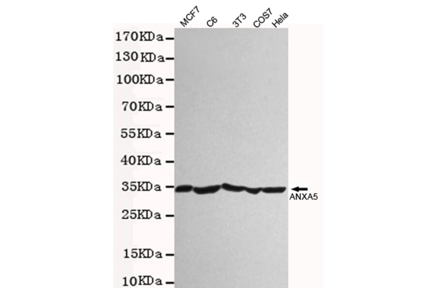 Western blot - Annexin V Polyclonal Antibody from Signalway Antibody (27222) - Antibodies.com