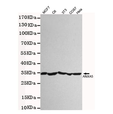 Western blot - Annexin V Polyclonal Antibody from Signalway Antibody (27222) - Antibodies.com