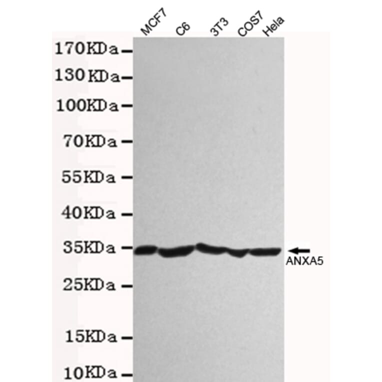Western blot - Annexin V Polyclonal Antibody from Signalway Antibody (27222) - Antibodies.com