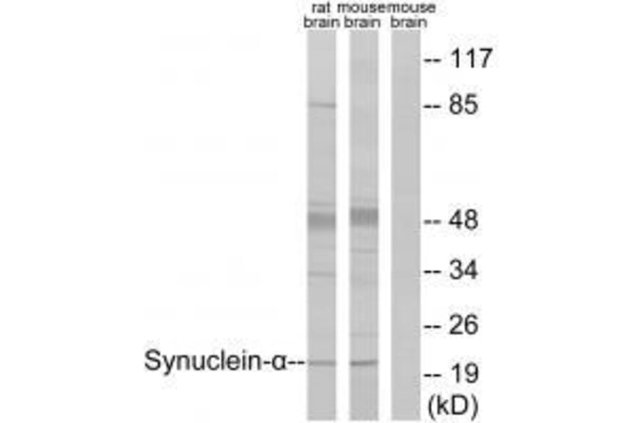 Western blot - Synuclein-α (Ab-125) Antibody from Signalway Antibody (33205) - Antibodies.com