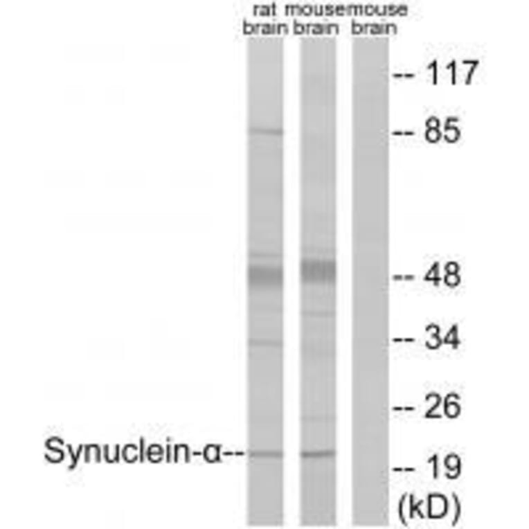 Western blot - Synuclein-α (Ab-125) Antibody from Signalway Antibody (33205) - Antibodies.com