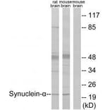 Western blot - Synuclein-α (Ab-125) Antibody from Signalway Antibody (33205) - Antibodies.com