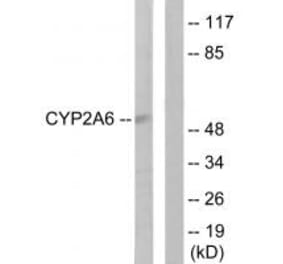 Western blot - Cytochrome P450 2A6 Antibody from Signalway Antibody (34232) - Antibodies.com