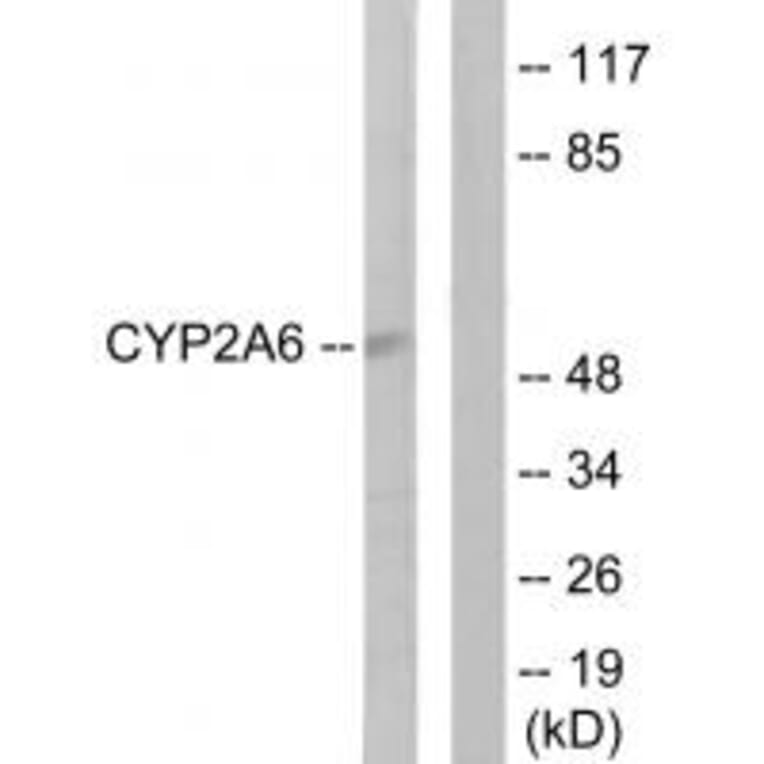 Western blot - Cytochrome P450 2A6 Antibody from Signalway Antibody (34232) - Antibodies.com