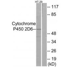 Western blot - Cytochrome P450 2D6 Antibody from Signalway Antibody (34237) - Antibodies.com