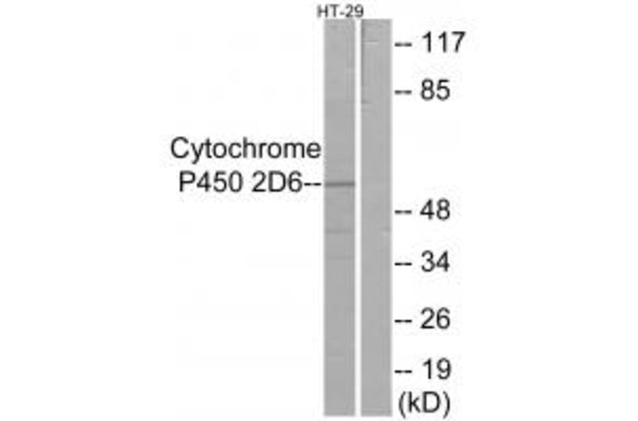 Western blot - Cytochrome P450 2D6 Antibody from Signalway Antibody (34237) - Antibodies.com