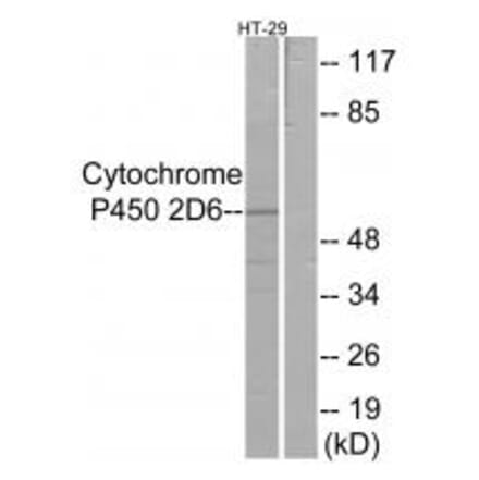 Western blot - Cytochrome P450 2D6 Antibody from Signalway Antibody (34237) - Antibodies.com