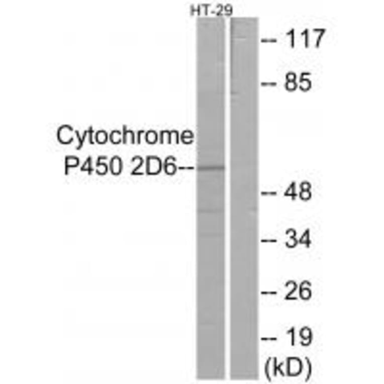 Western blot - Cytochrome P450 2D6 Antibody from Signalway Antibody (34237) - Antibodies.com