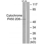 Western blot - Cytochrome P450 2D6 Antibody from Signalway Antibody (34237) - Antibodies.com