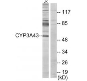Western blot - Cytochrome P450 3A43 Antibody from Signalway Antibody (34241) - Antibodies.com