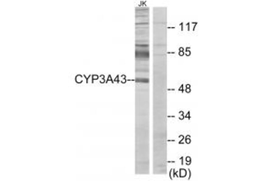 Western blot - Cytochrome P450 3A43 Antibody from Signalway Antibody (34241) - Antibodies.com