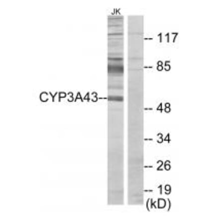 Western blot - Cytochrome P450 3A43 Antibody from Signalway Antibody (34241) - Antibodies.com