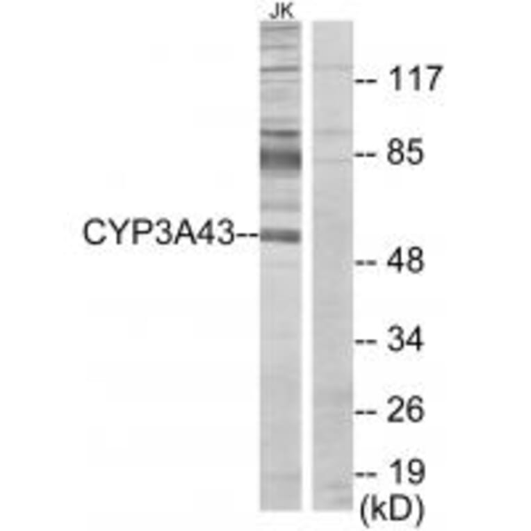 Western blot - Cytochrome P450 3A43 Antibody from Signalway Antibody (34241) - Antibodies.com