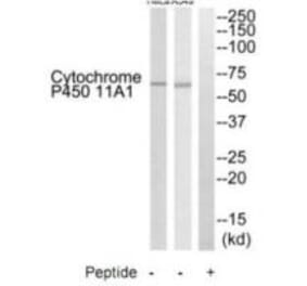 Western blot - Cytochrome P450 11A1 Antibody from Signalway Antibody (35214) - Antibodies.com