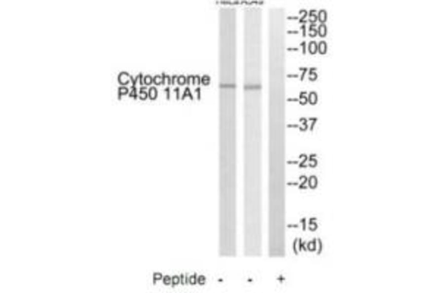 Western blot - Cytochrome P450 11A1 Antibody from Signalway Antibody (35214) - Antibodies.com