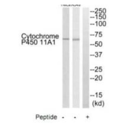 Western blot - Cytochrome P450 11A1 Antibody from Signalway Antibody (35214) - Antibodies.com