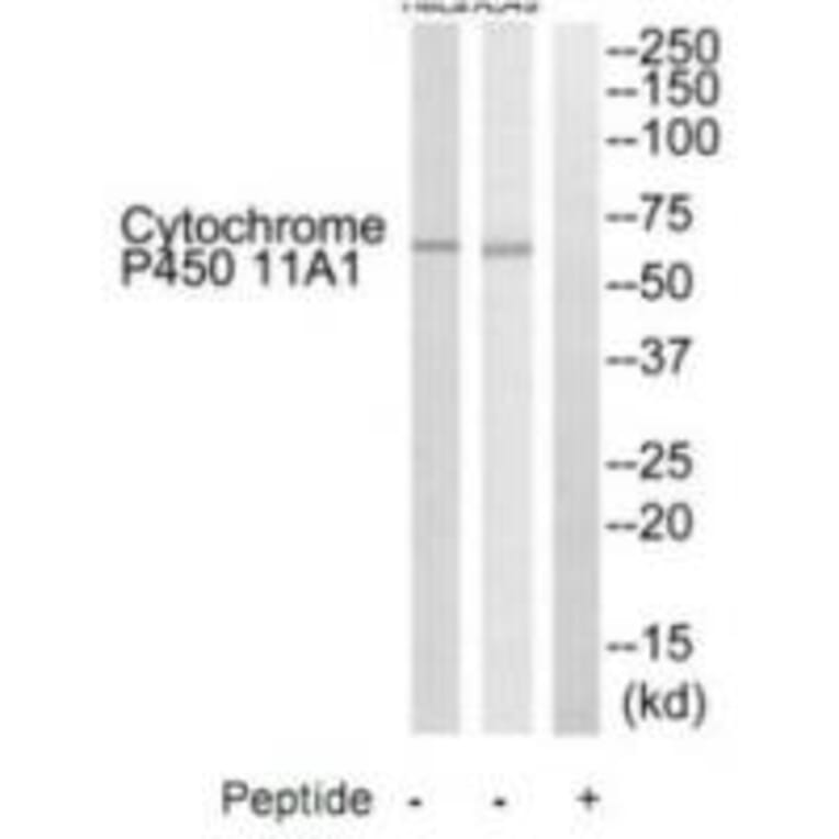 Western blot - Cytochrome P450 11A1 Antibody from Signalway Antibody (35214) - Antibodies.com