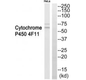 Western blot - Cytochrome P450 4F11 Antibody from Signalway Antibody (35261) - Antibodies.com