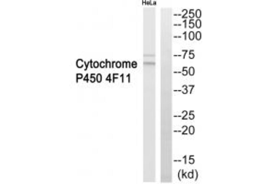 Western blot - Cytochrome P450 4F11 Antibody from Signalway Antibody (35261) - Antibodies.com