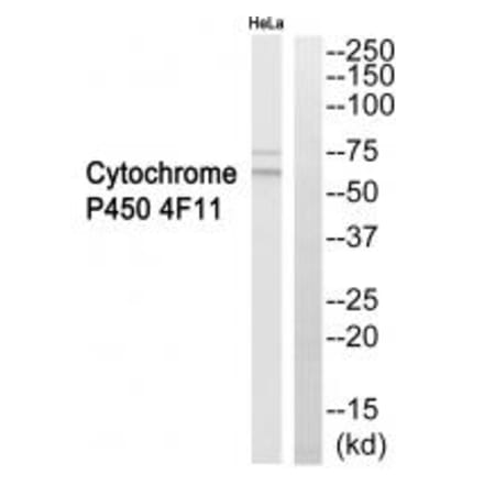 Western blot - Cytochrome P450 4F11 Antibody from Signalway Antibody (35261) - Antibodies.com