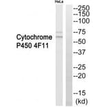 Western blot - Cytochrome P450 4F11 Antibody from Signalway Antibody (35261) - Antibodies.com