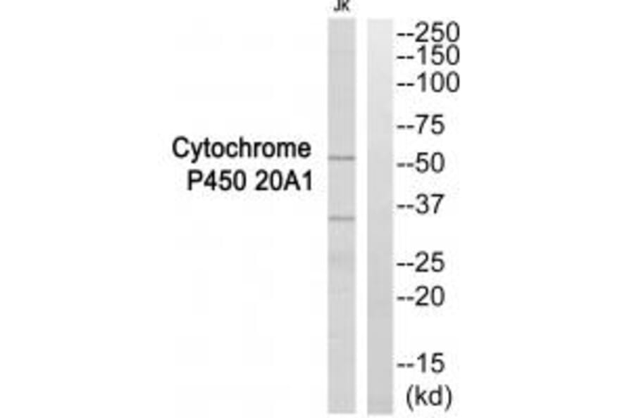 Western blot - Cytochrome P450 20A1 Antibody from Signalway Antibody (35271) - Antibodies.com