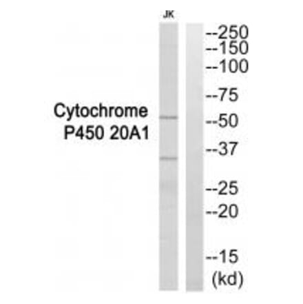 Western blot - Cytochrome P450 20A1 Antibody from Signalway Antibody (35271) - Antibodies.com