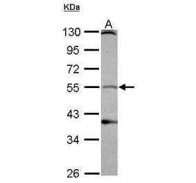 Dopamine Receptor D1 Antibody from Signalway Antibody (35341) - Antibodies.com