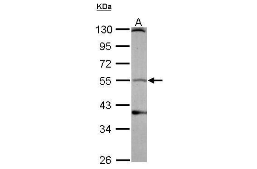 Dopamine Receptor D1 Antibody from Signalway Antibody (35341) - Antibodies.com